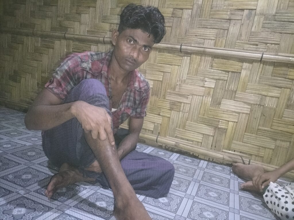 Uprooted by War: A Rohingya Elder’s Struggle for Survival Amid Genocide